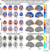 Sex differences in human brain anatomy