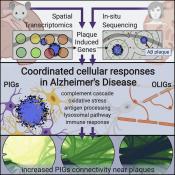 What happens around an Alzheimer plaque?