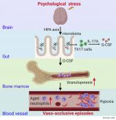 The Gut Microbiome Regulates Psychological-Stress-Induced Inflammation