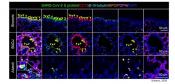 Mouse model of SARS-CoV-2 recapitulating all aspects of human disease developed!