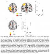 Neural mechanisms in physical fatigue