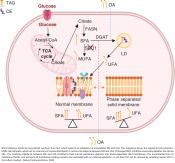 Lipid imbalance in the membranes of metastatic melanoma cells 