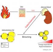 Burn Induces Browning of the Subcutaneous White Adipose Tissue 