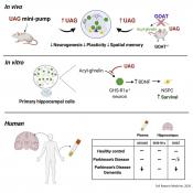 Unacylated gut hormone blocks neurogenesis and &nbsp;linked to Parkinson&#039;s dementia