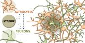 Stroke- astrocytes