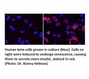 Cellular aging process unexpectedly enhances insulin secretion