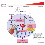 Rapid Elevation of Fatty Acid Metabolite May Act As a Tipping Point in Diabetes Development