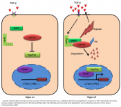 Mechanism of tumor progression in hypoxia