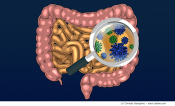 How altered gut microbes cause obesity