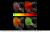 New noninvasive imaging method for showing oxygen in tissue