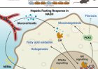 Intermittent fasting protects against liver inflammation and liver cancer