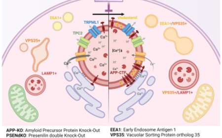 Disruption of organellar communication in early stages of Alzheimer's