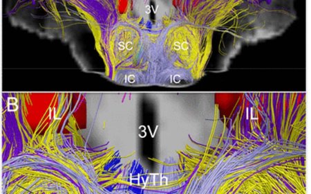 Sub-cortical connections critical to human consciousness identified!