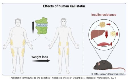 Role of human Kallistatin in weight loss