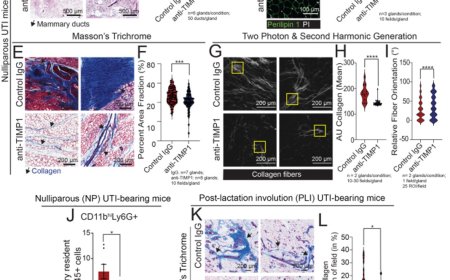 Link between UTI and breast changes!