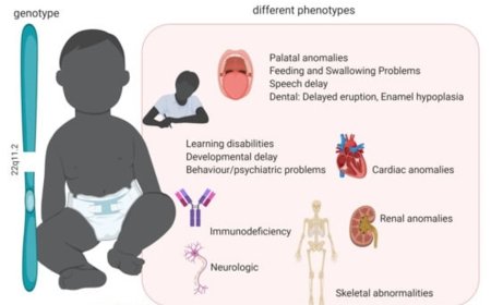 Chromosomal 22q11.2 deletion confers risk for severe spina bifida