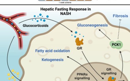 Intermittent fasting protects against liver inflammation and liver cancer