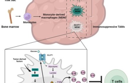 New immunosuppressive mechanism in brain cancer