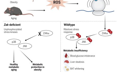 The ribotoxic stress response drives obesity and aging