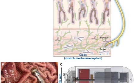 A vibrating, ingestible capsule that might help treat obesity