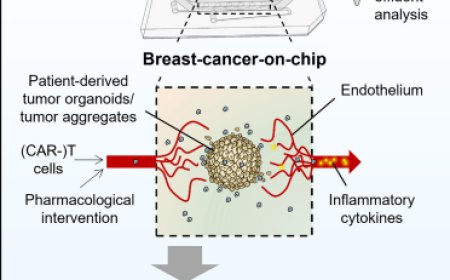 Breast cancer-on-chip for patient-specific efficacy and safety testing of CAR-T cells
