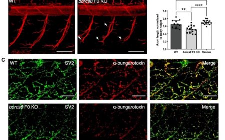 Biallelic BORCS8 variants cause an infantile-onset neurodegenerative disorder with altered lysosome dynamics