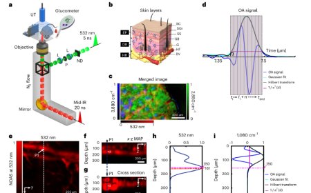 Non-invasive measurements of blood glucose levels by time-gating mid-infrared optoacoustic signals