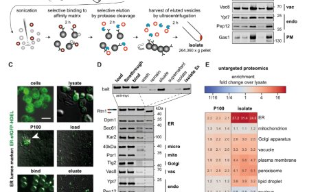 MemPrep, a new technology for isolating organellar membranes provides fingerprints of lipid bilayer stress