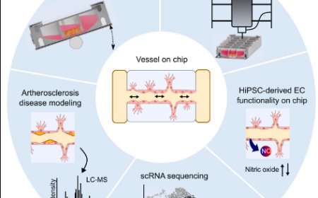 Stem cell-derived vessels-on-chip for cardiovascular disease modeling