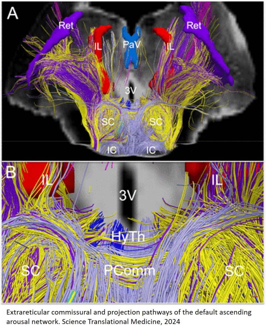 Sub-cortical connections critical to human consciousness identified!