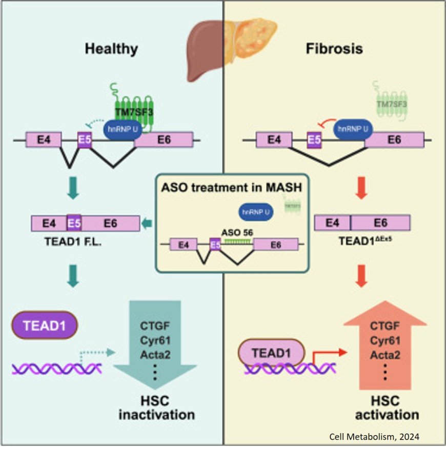 Role of alternative splicing  in liver fibrosis