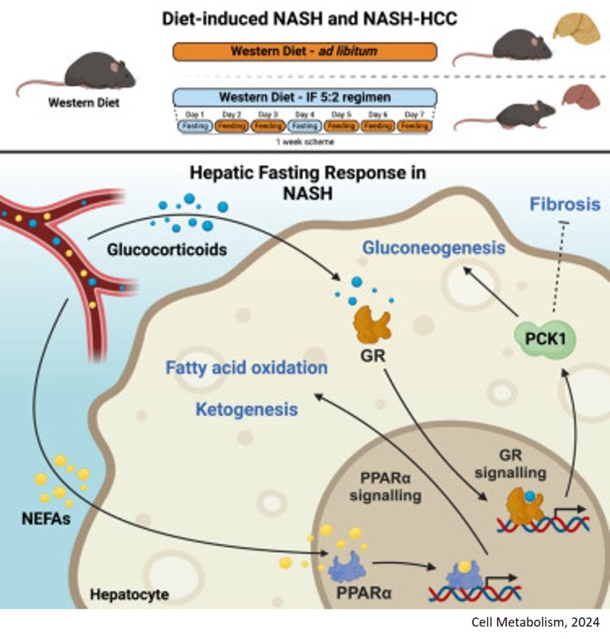 Intermittent fasting protects against liver inflammation and liver cancer