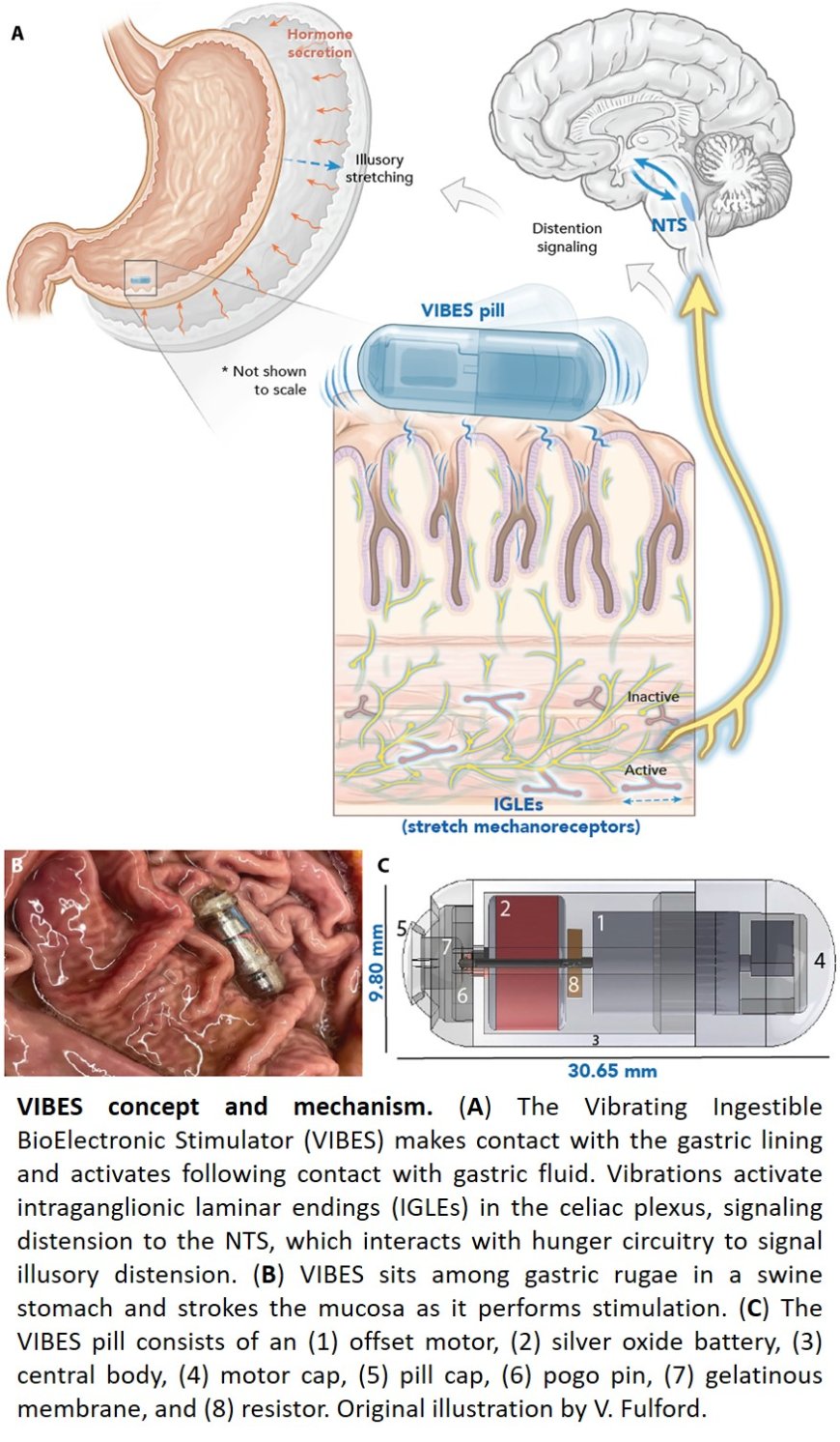 A vibrating, ingestible capsule that might help treat obesity