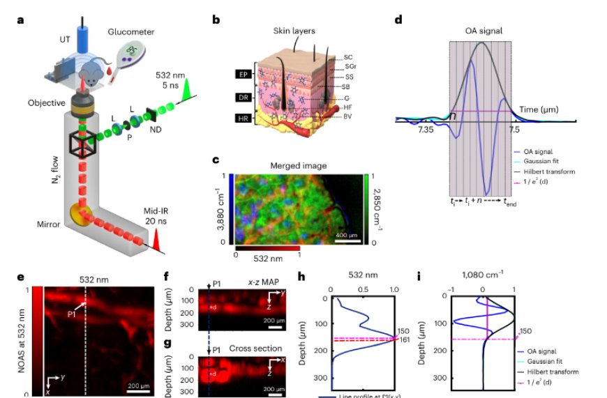 Non-invasive measurements of blood glucose levels by time-gating mid-infrared optoacoustic signals