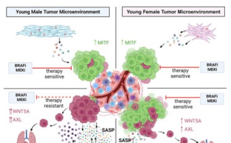 Sex disparity in cutaneous melanoma