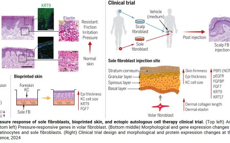 Injected fibroblasts transform to give thin skin a tough new identity