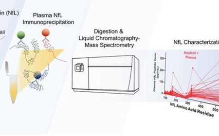 Plasma neurofilament light chain assay for preclinical and mild Alzheimer’s disease