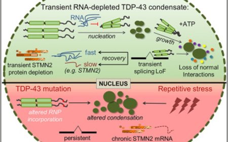 Mechanism of cellular stress induced neurodegeneration