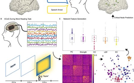 Vital language sites in brain act like connectors in a social network