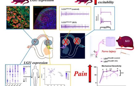 A role for leucine-rich, glioma inactivated 1 in regulating  pain sensitivity