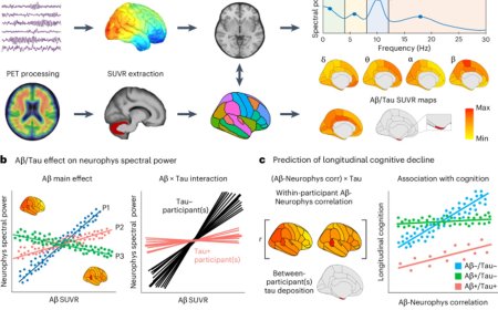 Understanding changes in pre-clinical Alzheimer’s disease