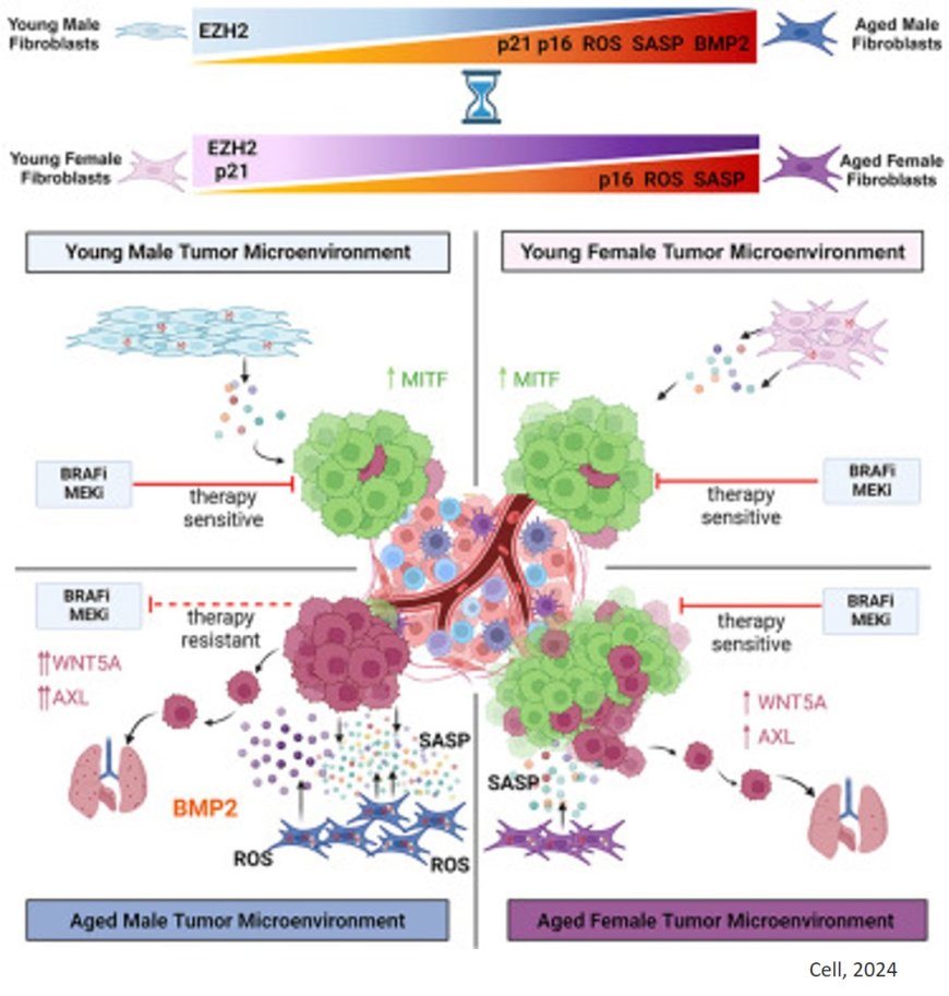 Sex disparity in cutaneous melanoma