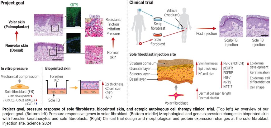 The use of ectopic volar fibroblasts to modify skin identity