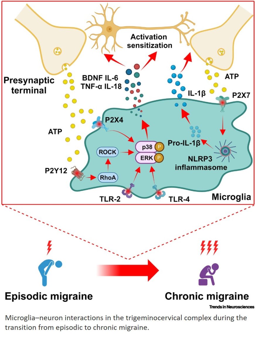 Neuroimmune interactions in the development and chronification of migraine headache