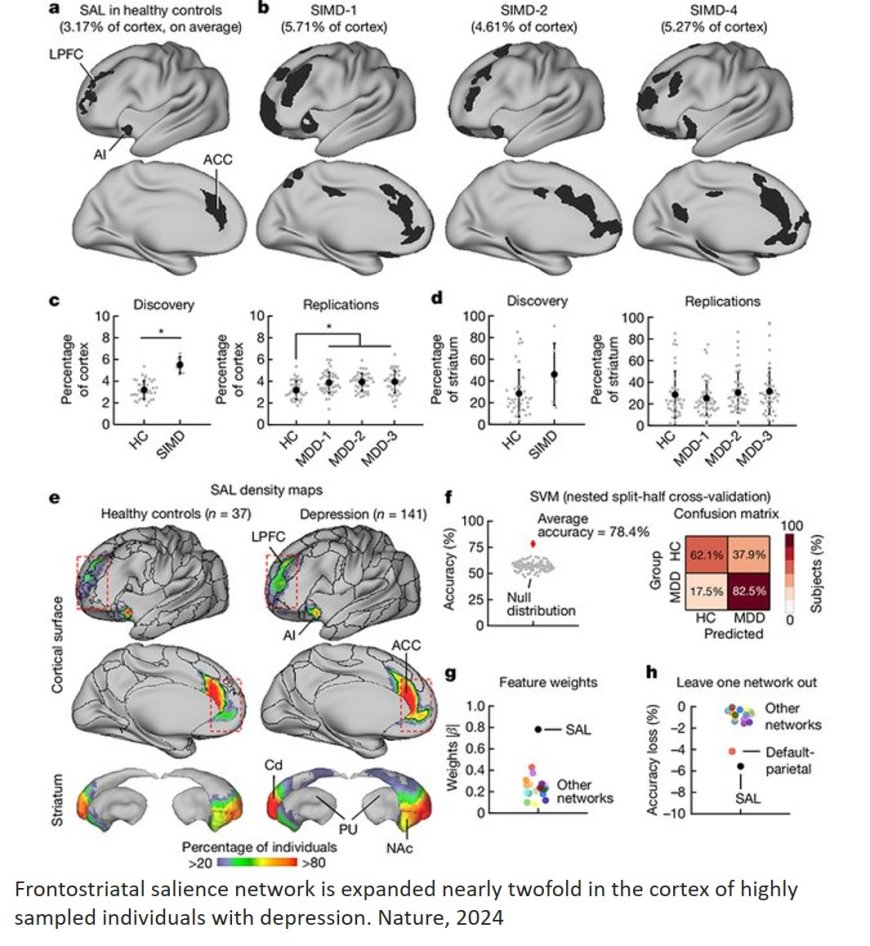 Frontostriatal salience network expansion in individuals in depression