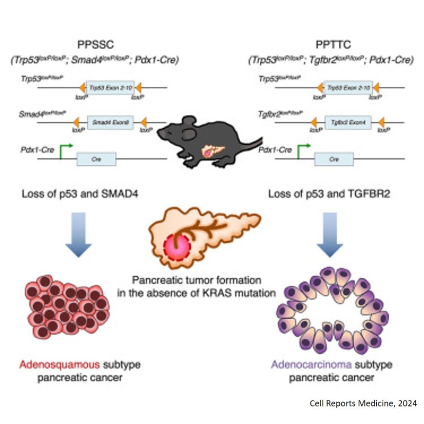 Loss of p53 and SMAD4 induces adenosquamous subtype pancreatic cancer in the absence of an oncogenic KRAS mutation