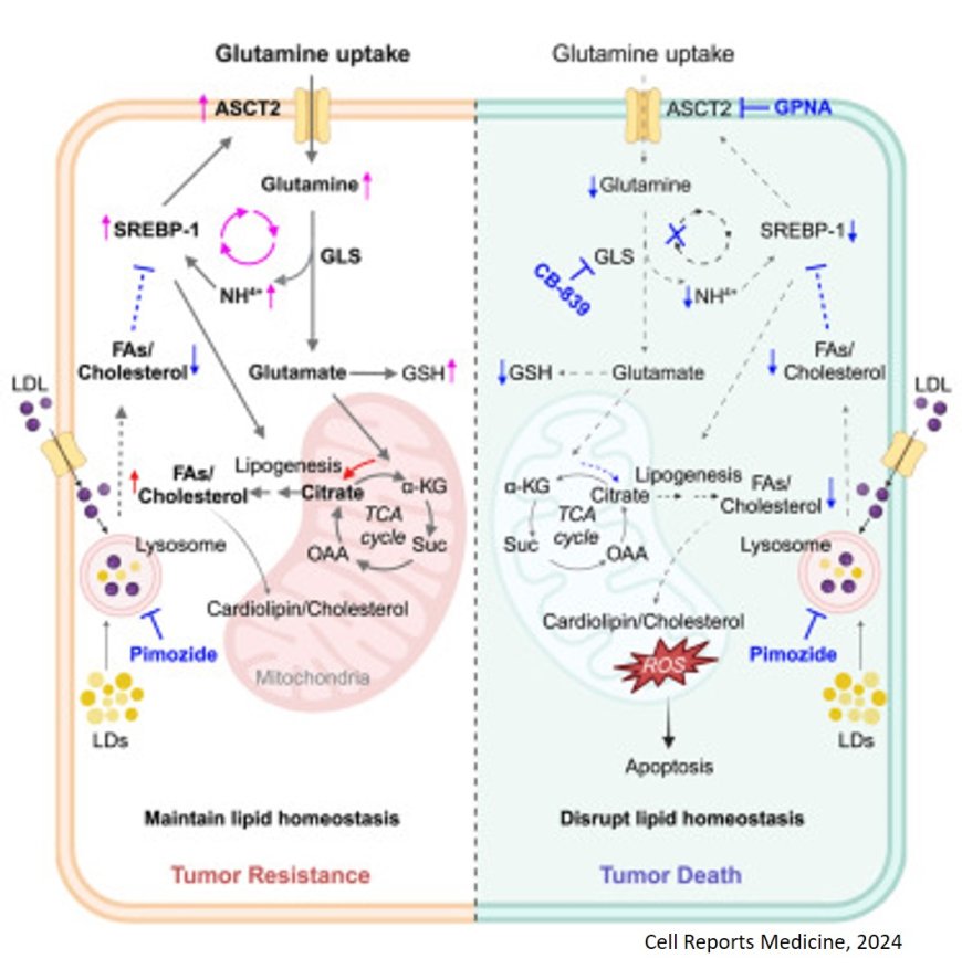 Combinatorial targeting of glutamine metabolism and lysosomal-based lipid metabolism effectively suppresses glioblastoma