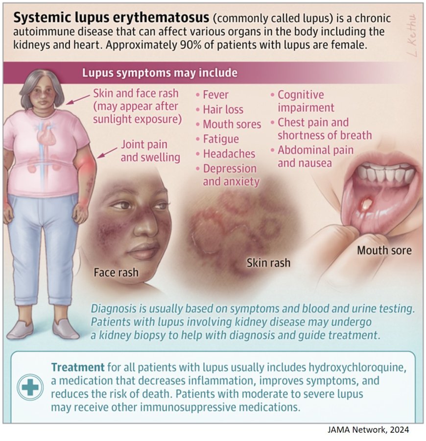 What Is Lupus?