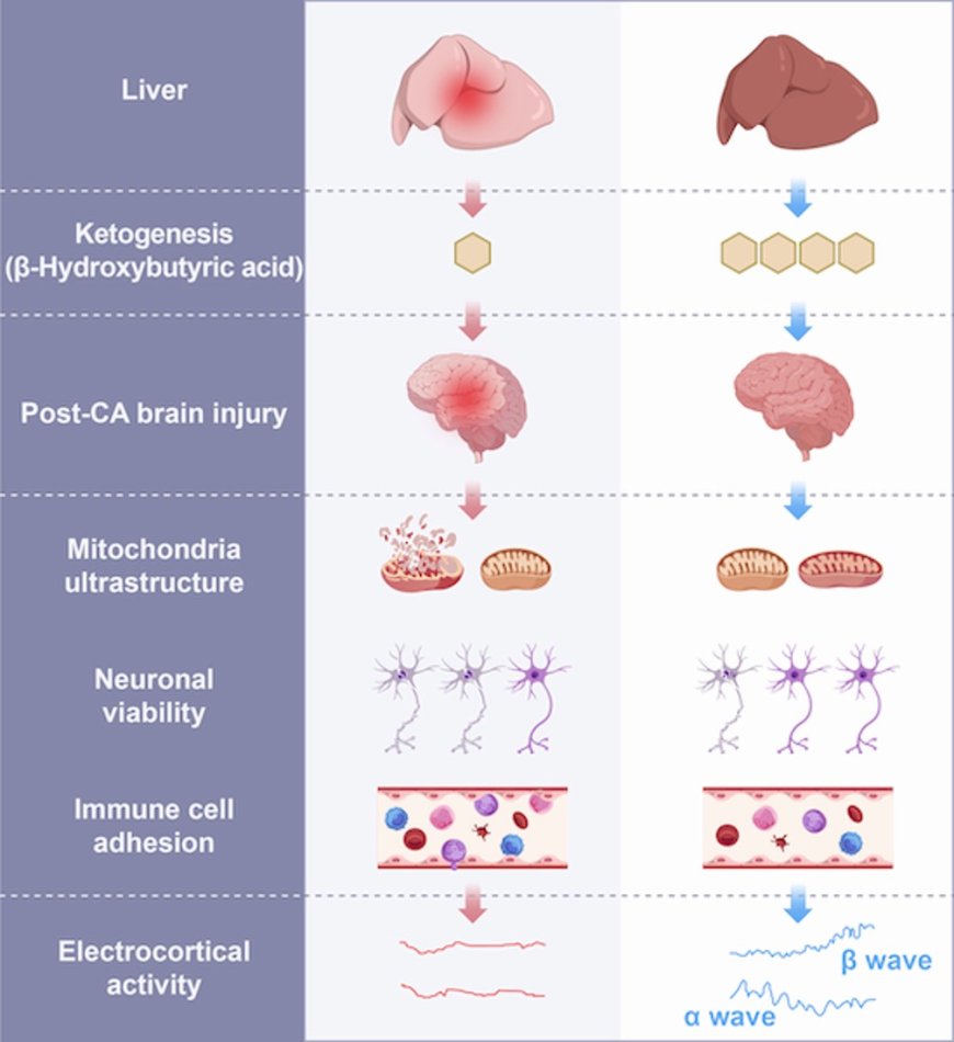 Liver protects neuron viability and electrocortical activity in post-cardiac arrest brain injury