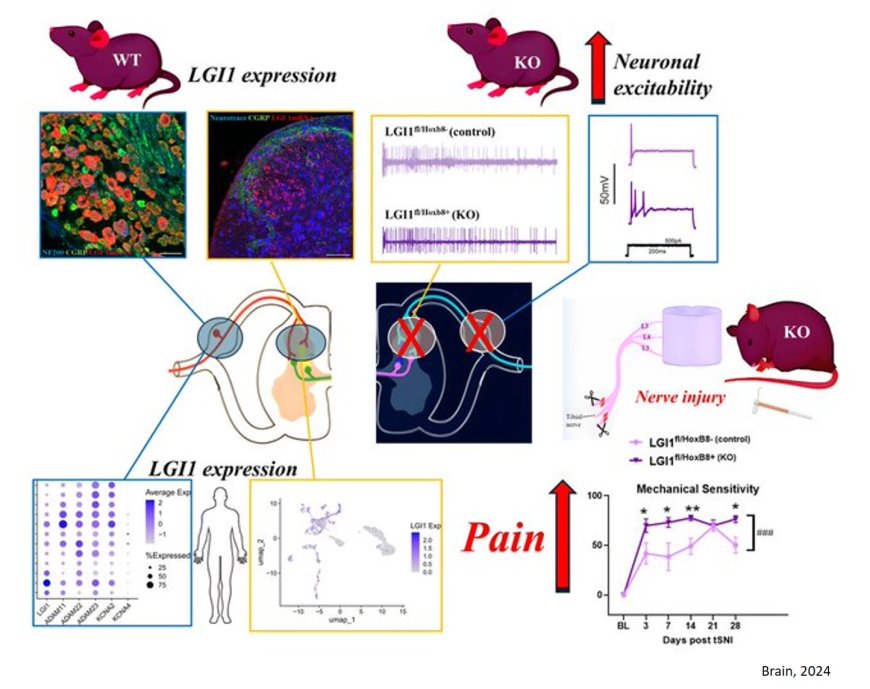 A role for leucine-rich, glioma inactivated 1 in regulating  pain sensitivity